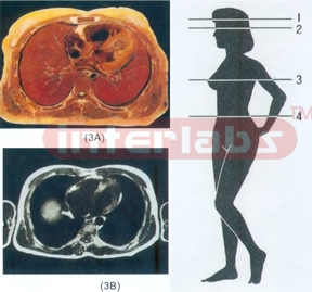 ANATOMICAL DISL MODEL OF FEMALE HUMAN TORSO Section 3